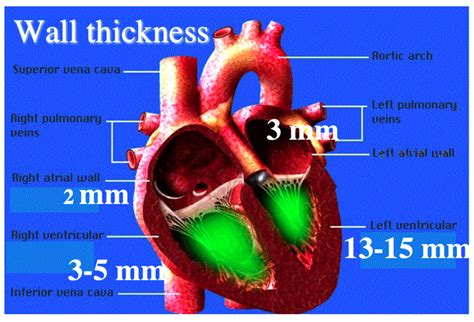 when you measured thickness of ventricular walls|heart wall thickness chart.